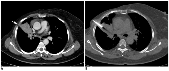 Fig. 25