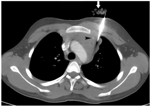 Fig. 18