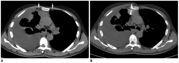 Fig. 17