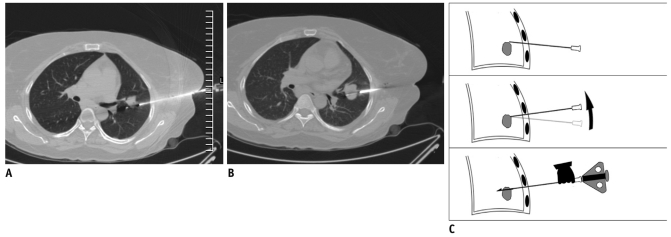 Fig. 13