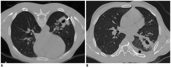 Fig. 30