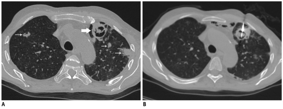 Fig. 27