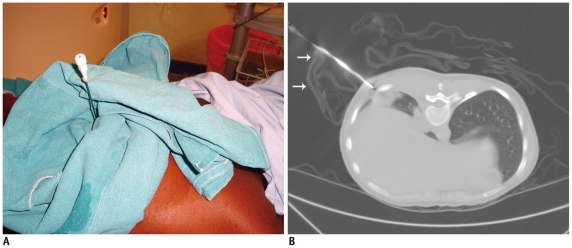 Fig. 9