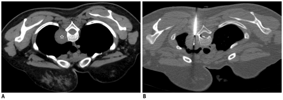 Fig. 31