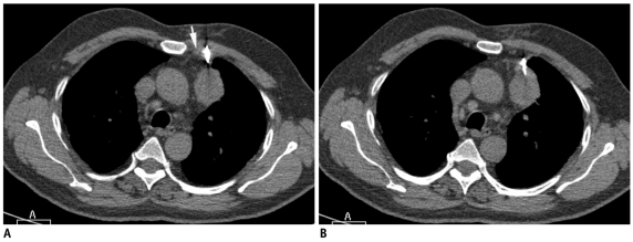 Fig. 26