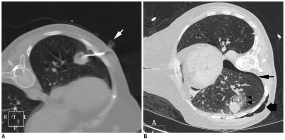 Fig. 29