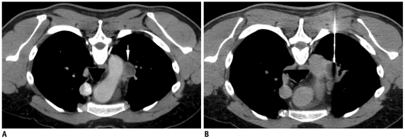 Fig. 23