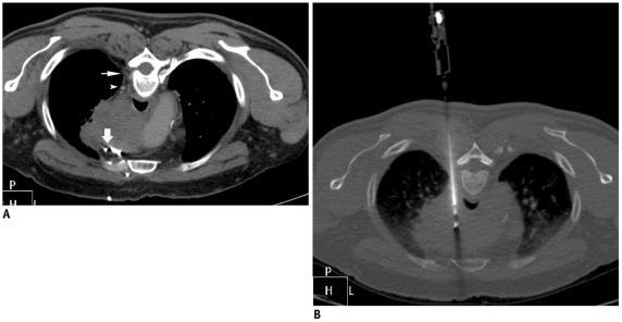 Fig. 20