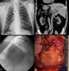 Fig. 1