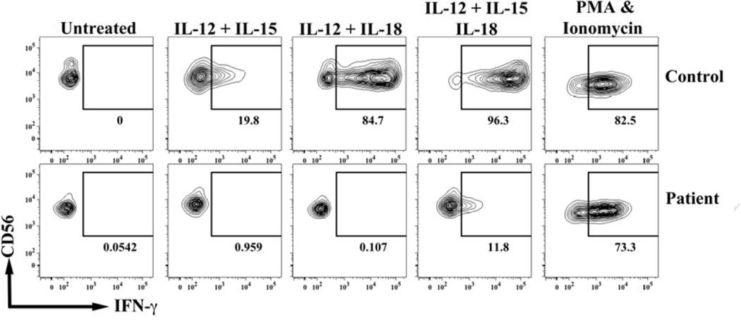 FIG. 1