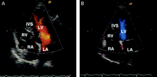 Figure 2  