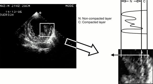 Figure 1  