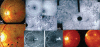 Figure 18