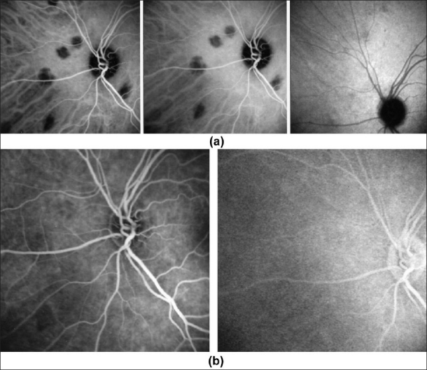 Figure 17