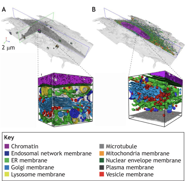 Box 3. Case study: automatic whole cell organelle segmentation in volumetric electron microscopy