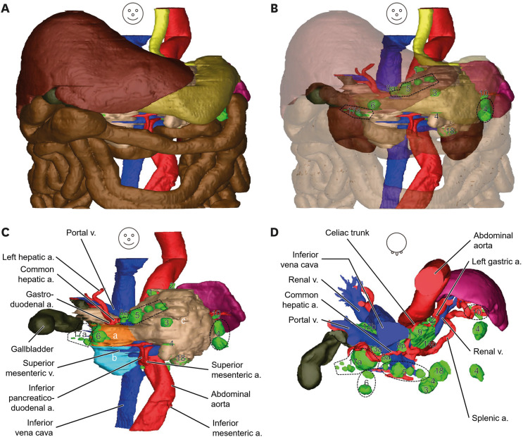 Lymph Node Stations of Pancreas Which Are Identified in Real Color ...