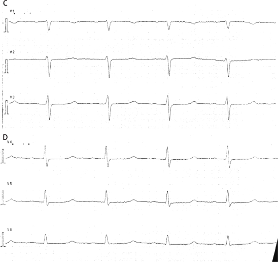 Figure 1A-D