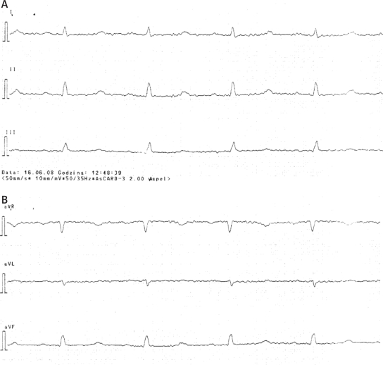 Figure 1A-D