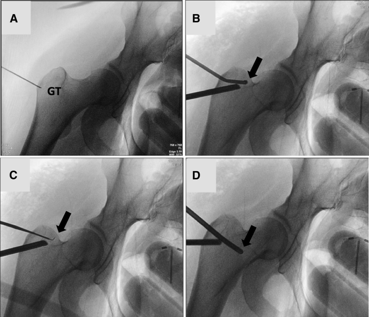 Fig 3