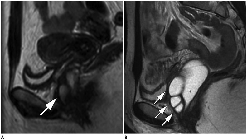 Fig. 12