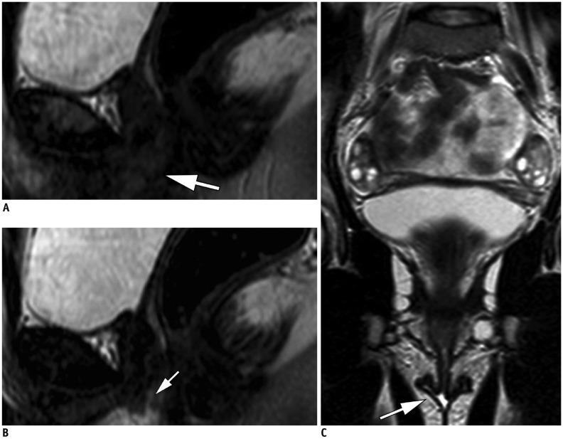 Fig. 11