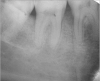 Figure 6c