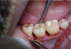 Figure 2a