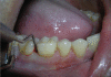 Figure 1a