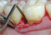 Figure 2b