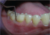 Figure 6a
