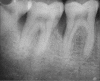 Figure 1c