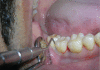Figure 1b