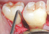 Figure 2c