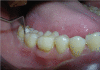 Figure 6b