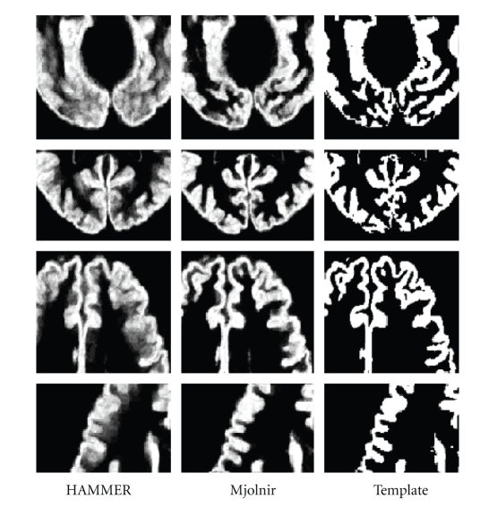 Figure 13