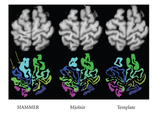 Figure 14