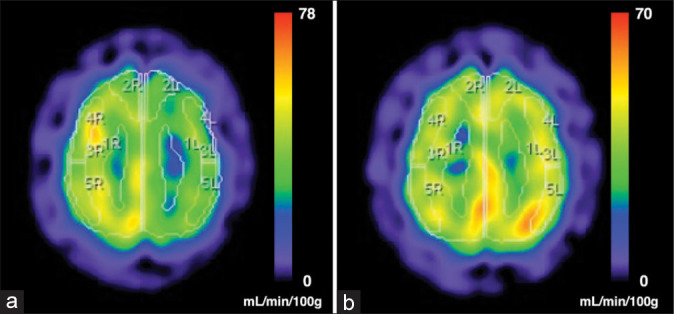 Figure 3: