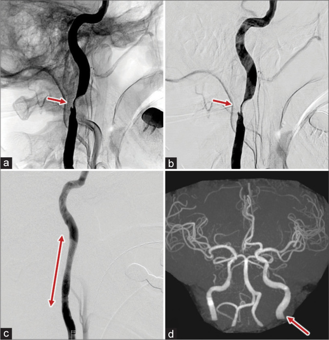 Figure 2: