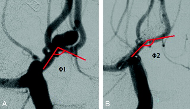 Fig 3.