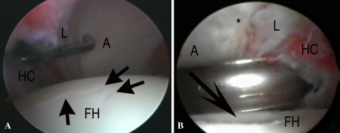 Fig. 1A–B