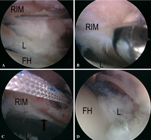 Fig. 4A–D