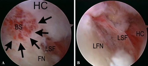 Fig. 7A–B