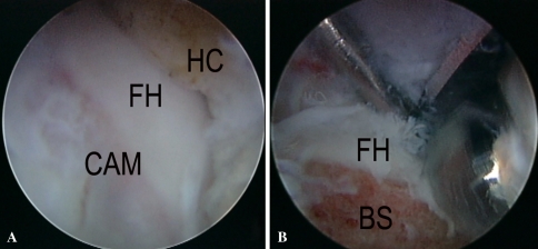 Fig. 6A–B