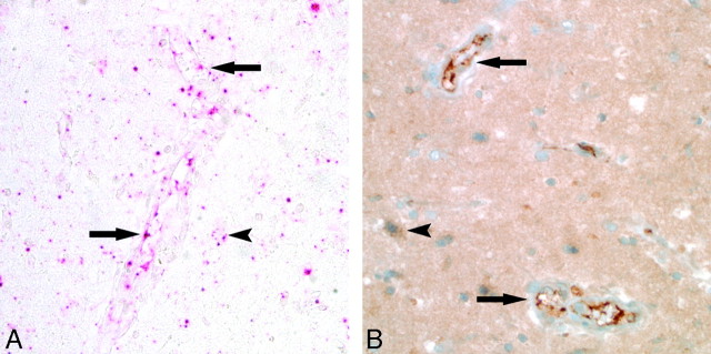 Fig 4.