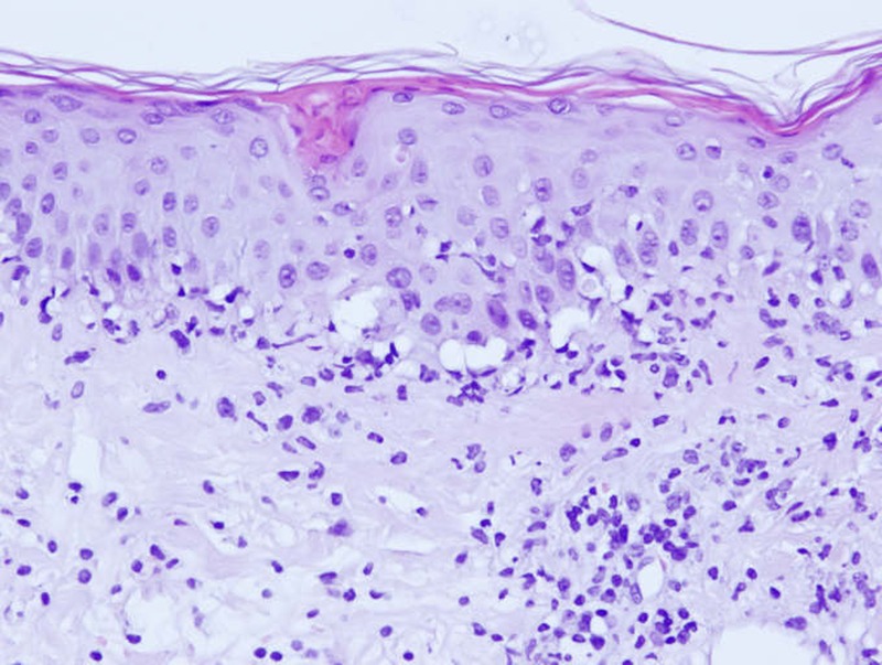 Figure 6