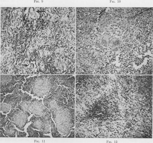 Fig. 9., Fig. 10., Fig. 11., Fig. 12.