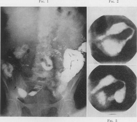 Fig. 1., Fig. 2 and 3.