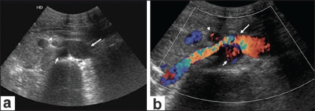 Figure 1 (a,b)