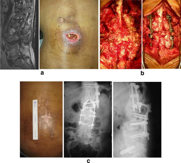 Fig. 2