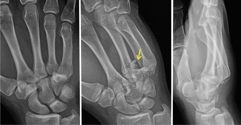 Fig. 1